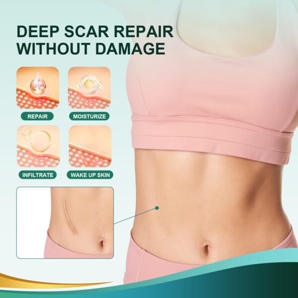 Medical Grade Silicone Scar Sheets, Silicone Scar Tape (1.6”x 60” Roll-1.5M), Professional Scar Removal Treatment, Reusable Silicone Scar Strip for Keloid, C-Section, Surgery, Burns, Acne Etc