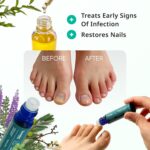 Swissklip KlearNail Toenail Stick | Medi-Care Treatment | Natural Solution for Healthy Nails I Suitable For Foot, Toe, and Fingernail I For Brittle Toenails – 10ml / 0.3 Fl. Oz. Pack 1 - Made in USA