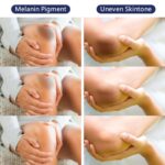 Intimate Areas Skin Lightening Cream Bleaching Cream For Body Sensitive Intimate Area, Private Parts, Underarm, Knees, Elbows, Inner Thigh, Bikini Areas, Bikini Line, Natural Skin Whitening.