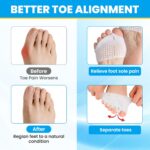 Metatarsal Pads for Women & Men - 4Pcs Gel Toe Separators Ball of Foot Cushions for Pain Relief, Metatarsalgia, Foot Pads for Walking, Standing, Running