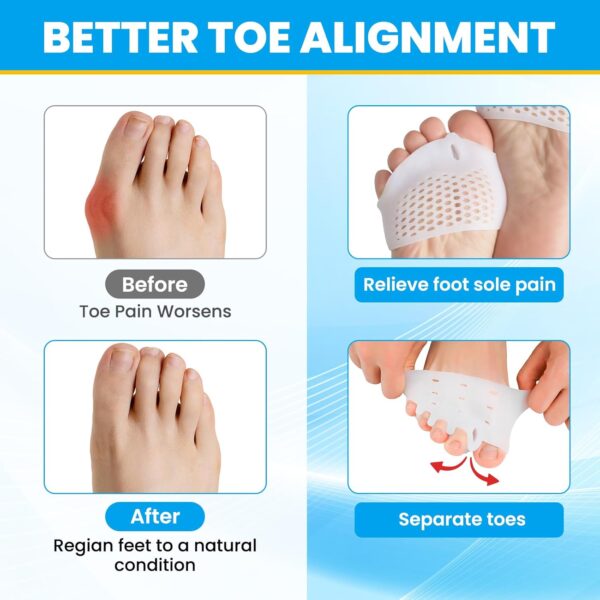 Metatarsal Pads for Women & Men - 4Pcs Gel Toe Separators Ball of Foot Cushions for Pain Relief, Metatarsalgia, Foot Pads for Walking, Standing, Running