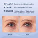 SKIN ULTIMA Dual Eye Cream with Advanced Retinol, Peptides, Caffeine for Puffy Eyes and Dark Circles, Wrinkles, Anti Aging, Under Eye Bags Treatment, Instant Tightener, Fragrance Free, 0.68 OZ