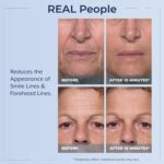 Plexaderm Rapid Reduction Eye Serum - Visibly Reduces Under-Eye Bags, Wrinkles, Dark Circles, Fine Lines & Crow's Feet Instantly, Anti Aging Wrinkle Remover for Face, Full Size Tube