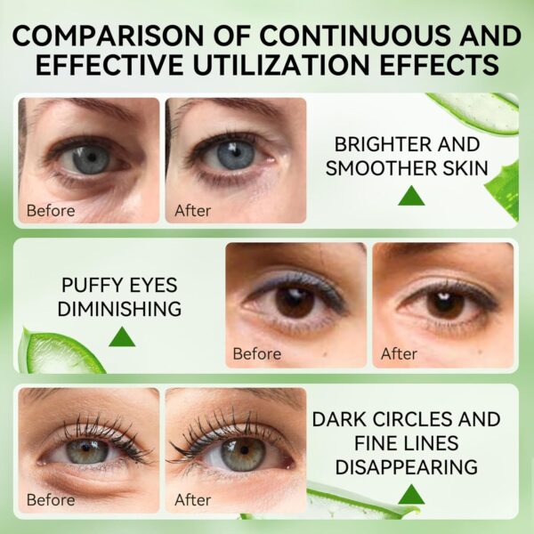 LANBENA Aloe Vera Under Eye Patches for Puffy Eyes and Dark Circles Collagen Eye Gels Mask - Skin Treatment Pads Hydration and Skin Elasticity-30 Pairs