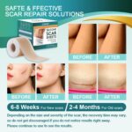 Medical Grade Silicone Scar Sheets, Silicone Scar Tape (1.6”x 60” Roll-1.5M), Professional Scar Removal Treatment, Reusable Silicone Scar Strip for Keloid, C-Section, Surgery, Burns, Acne Etc