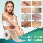 Medical Grade Silicone Scar Sheets, Silicone Scar Tape (1.6”x 60” Roll-1.5M), Professional Scar Removal Treatment, Reusable Silicone Scar Strip for Keloid, C-Section, Surgery, Burns, Acne Etc